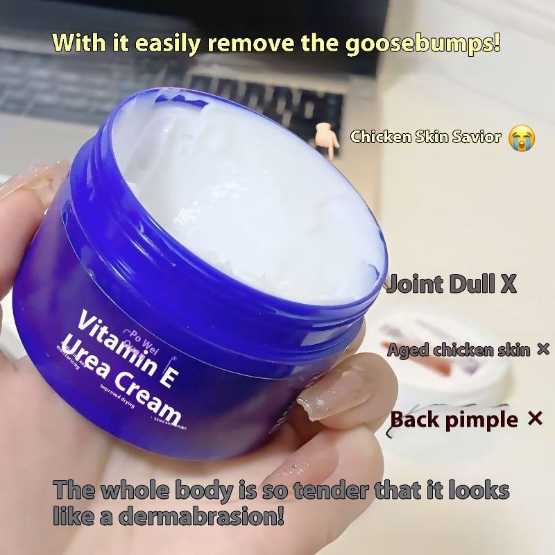 Vitamin E Urea Cream 10% Chicken Skin Removal Body Lotion Hydrating Moisturizing Hand Cream Vitamin E Lotion